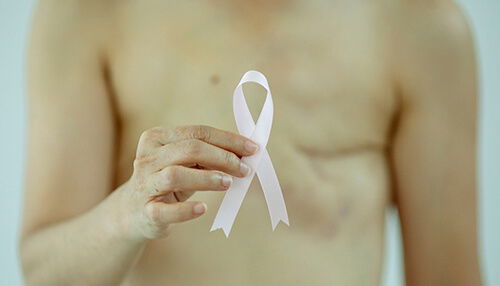 Who can get a mastectomy breast reconstruction surgeries