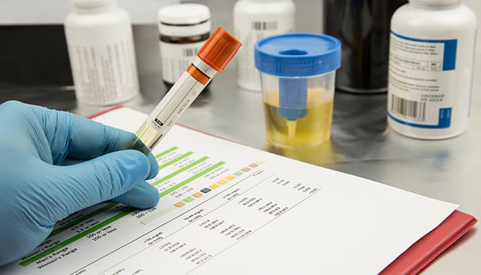 Urine test drug screening